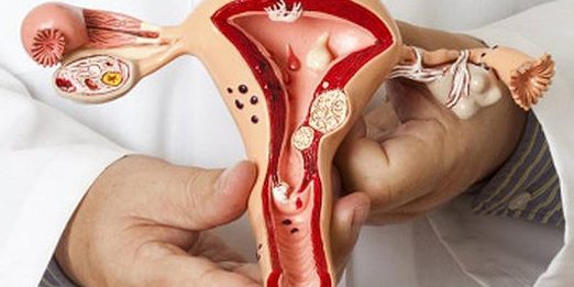Лечение в гинекологии – воспаление шейки матки и других женских органов
