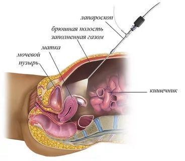 Роль фаллопиевых труб в зачатии